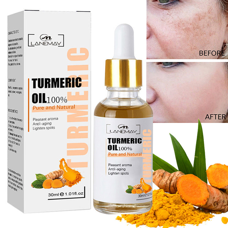 Turmeric Freckle Whitening Face Serum Fades Melasma Dark Spots Removal Pigment Melanin Correcting Essence Beauty Skin Care 30ml