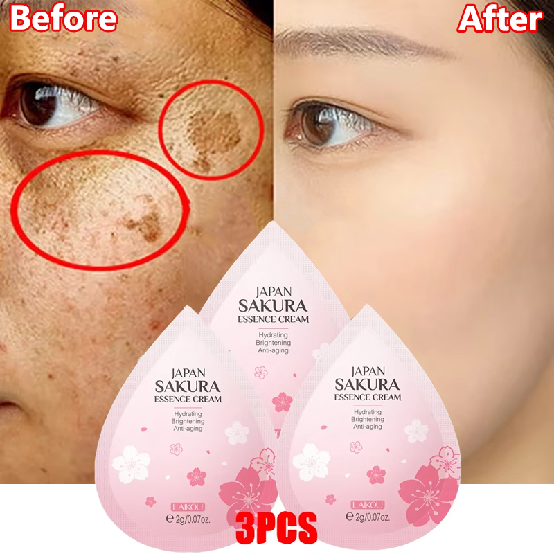 Effective Whitening Freckles Face Cream Dark Spot Corrector Remove Melasma Fade Melanin Pigmentation Brighten Skin Care Products
