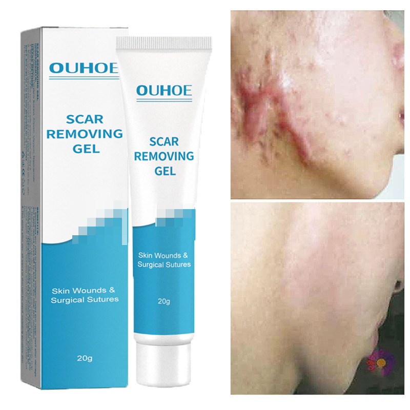 Herbal Scar Removal Cream Stretch Marks Repair Acne Spots Burn Surgical Old New Scar Treatment Whitening Smoothing Gel Skin Care