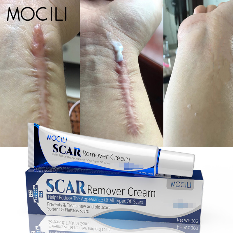 Herbal Acne Scar Removal Cream Burn Surgical Scar Stretch Marks Repair Cesarean Scar Treatment Pigmentation Corrector Body Care