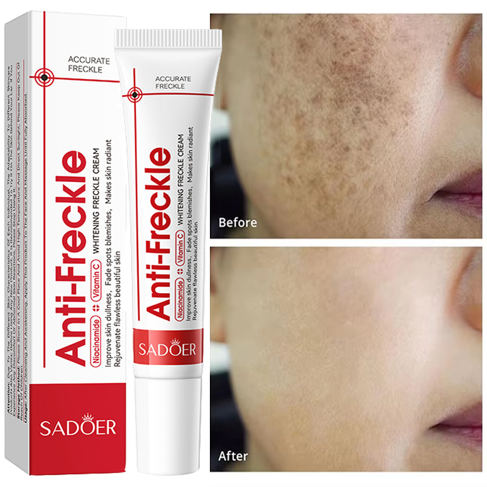 Effective Whitening Freckles Face Cream Dark Spot Corrector Remove Melasma Fade Melanin Pigmentation Brighten Skin Care Products