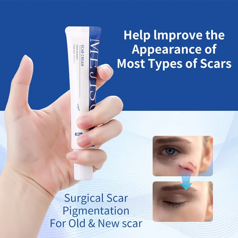 Scar Removal Cream Gel Remove Acne Spots Treatment Stretch Marks Burn Surgical Scar Repair Cream Smoothing Whitening Skin Beauty