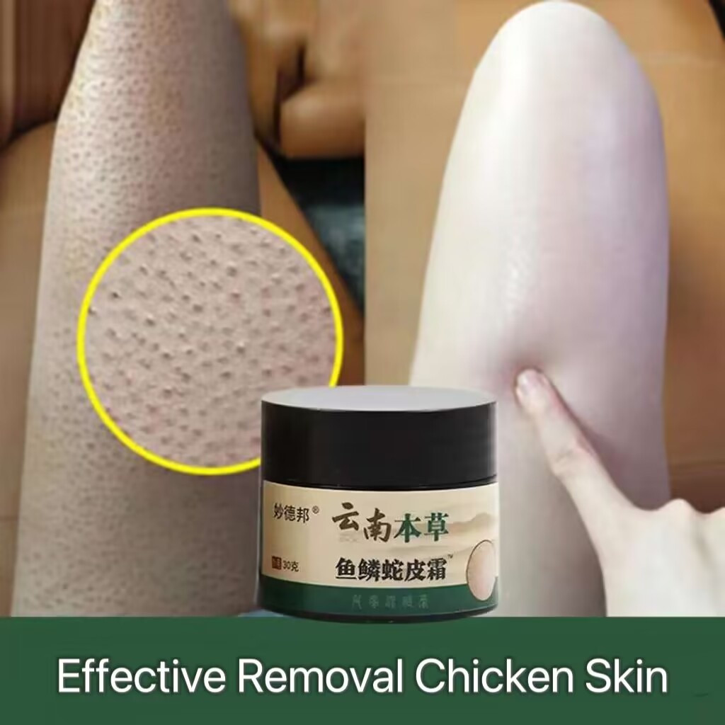 Curing Keratosis Follicle Pilaris Repair Cream Body Chicken Skin Dark Spot Remove Lotion Pore Smooth Whitening Moisturizing Care