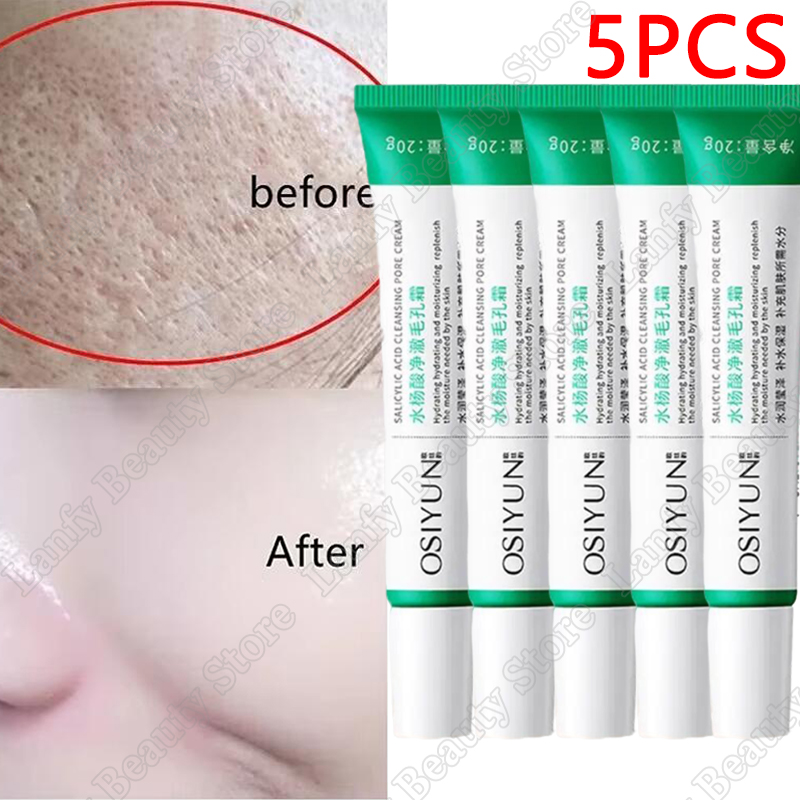 Salicylic Acid Pore Clearing Cream Shrink Pores Remove Blackheads Acne Brighten Moisturizing Smooth Skin Care Korean Products