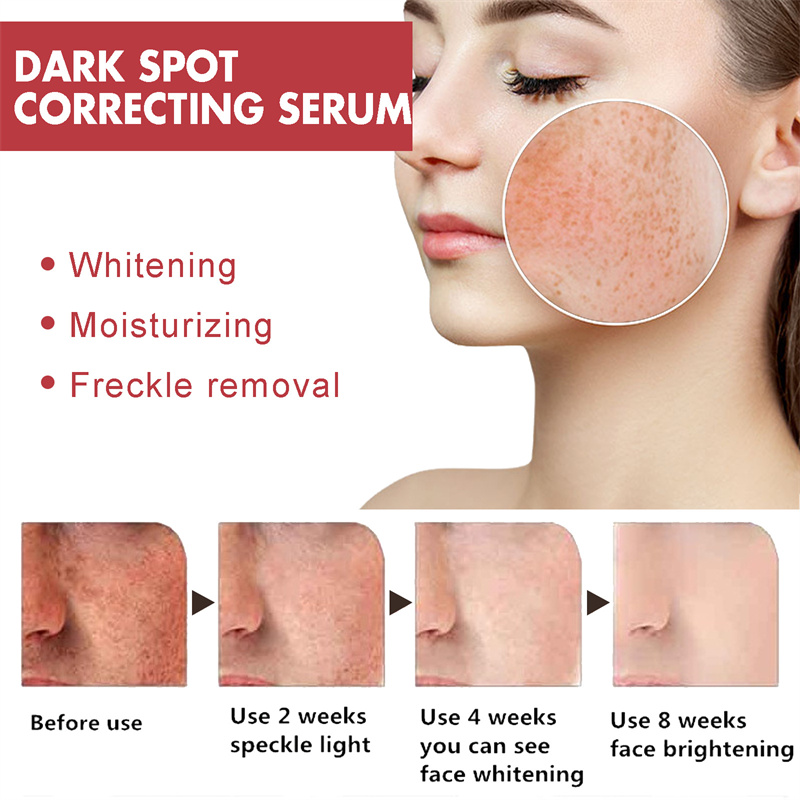 Dark Spots Remover Whitening Serum Face Freckle Melanin Correcting Reduce Fine Lines Brighten Essence Korean Beauty Skin Care
