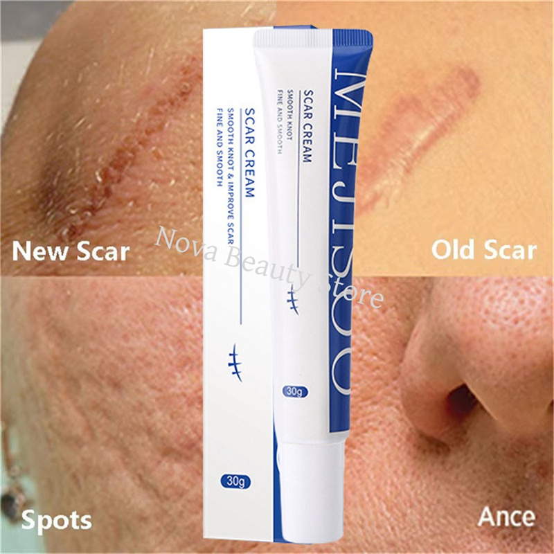 Scar Removal Cream Gel Remove Acne Spots Treatment Stretch Marks Burn Surgical Scar Repair Cream Smoothing Whitening Skin Beauty