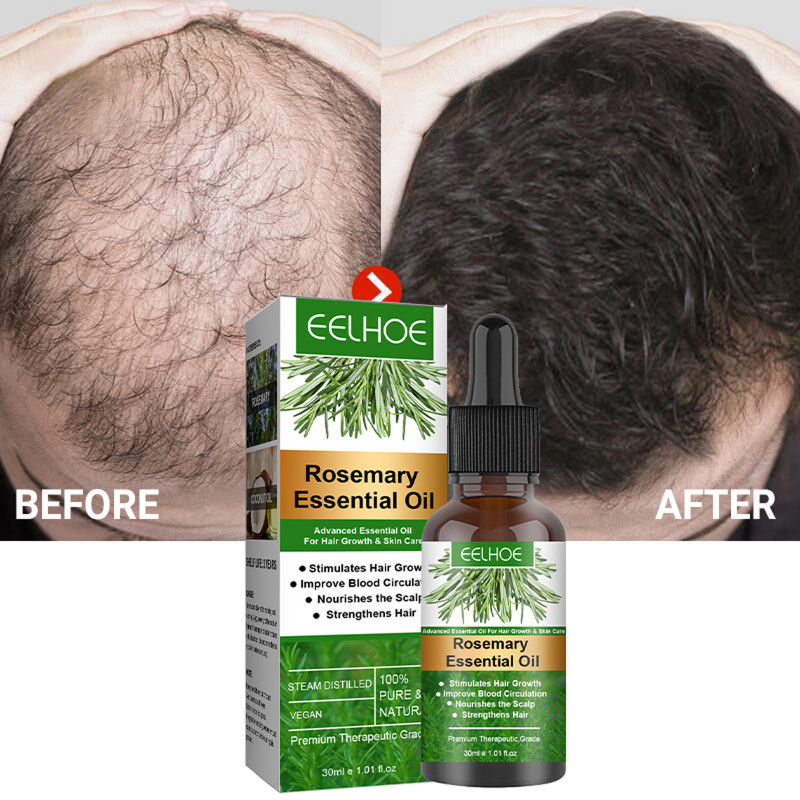 EELHOE Rosemary Hair Growth Essential Oil - Stimulate Growth, Nourish  Scalp, Strengthen Hair - 30ml