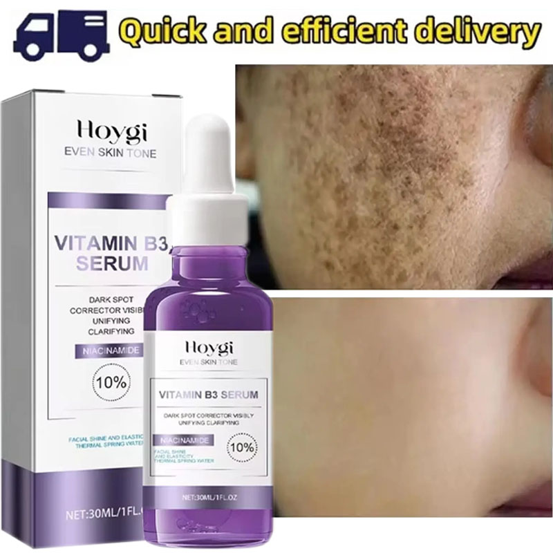 Powerful Dark Spots Remover Whitening Serum Face Freckle Melanin Correcting Anti Pigmentation Brighten Skin Beauty Care Products
