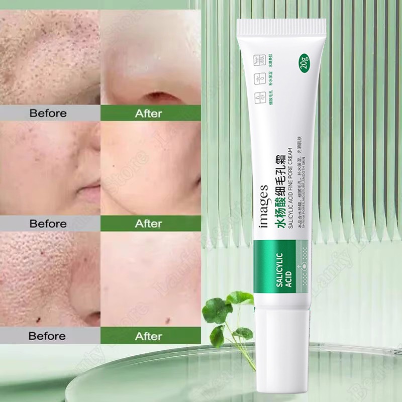 Salicylic Acid Pore Clearing Cream Shrink Pores Remove Blackheads Acne Brighten Moisturizing Smooth Skin Care Korean Products