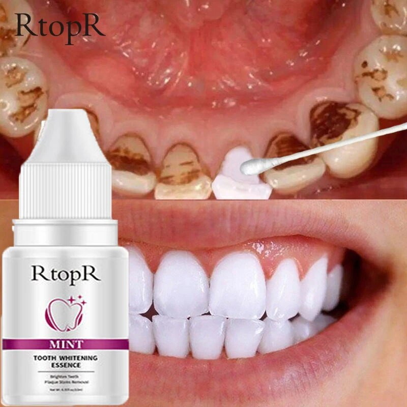 10 Pcs Teeth Whitening Serum Remove Yellow Plaque Smoke Stains Cleaning Oral Hygiene Essence Fresh Breath Bleaching Dental Care