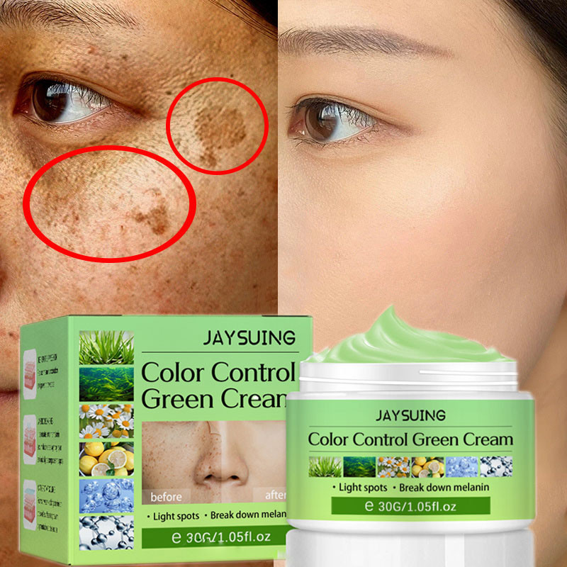 Whitening Freckles Face Cream Removal Melasma Dark Spot Lightening Melanin Brightening Moisturizing Anti-Aging Beauty Skin Care