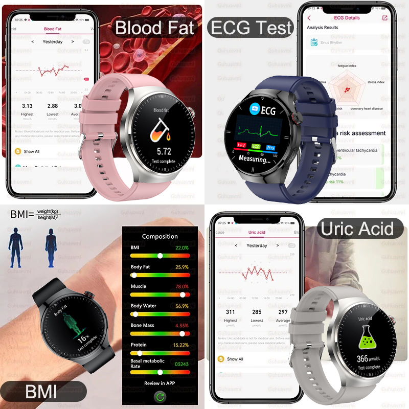 2025 New For XIAOMI Accurate Blood Lipid Uric Acid Smart Watch Men Women ECG+PPG Blood pressure Bluetooth call Health Smartwatch