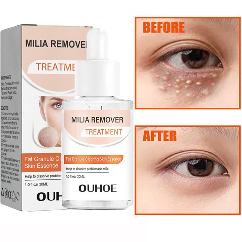 Collagen Remove Eye Fat Granule Serum Wrinkle Remover Fade Dark Circles Eye Bags Smooth Pores Essence Korean Skin Care Products
