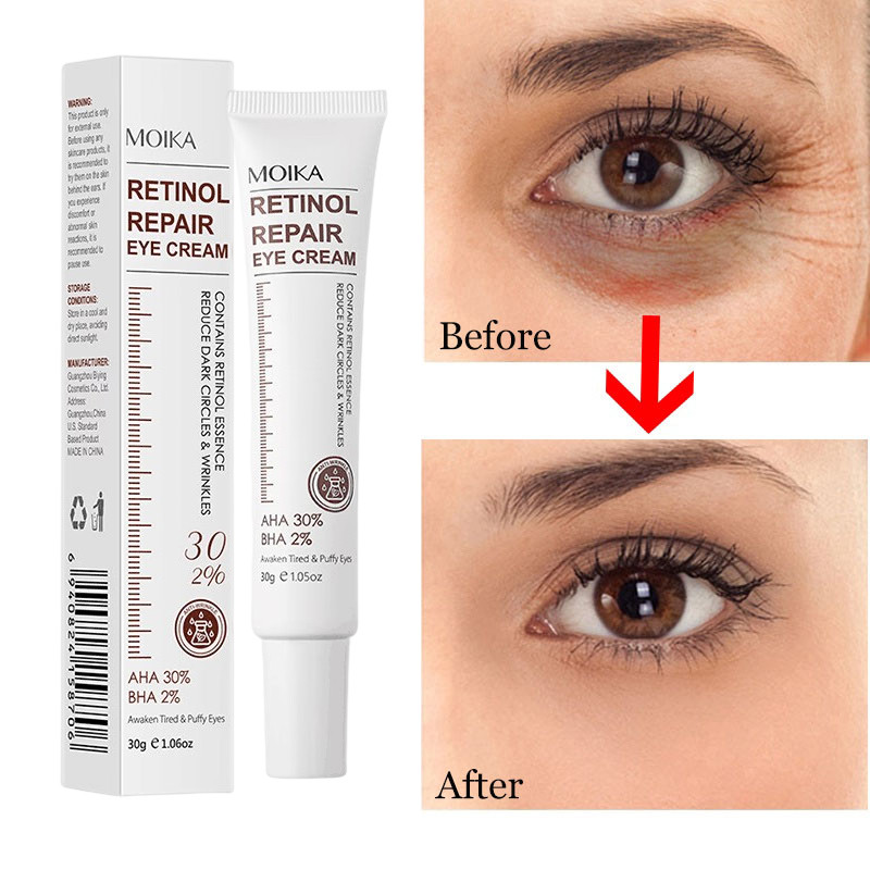 Retinol Anti-wrinkle Eye Cream Remove Eye Bags Dark Circle Fades Fine Lines Lifting Firming Eye Serum Moisturizing Skin Care 30g