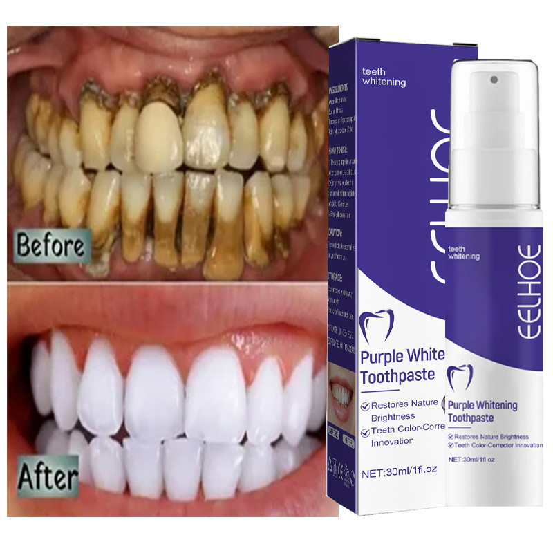 Teeth Cleansing Whitening Toothpaste Whitener Bleach Gel Remove Stains Plaque Fresh Breath Cleaning Oral Hygiene Korea Products