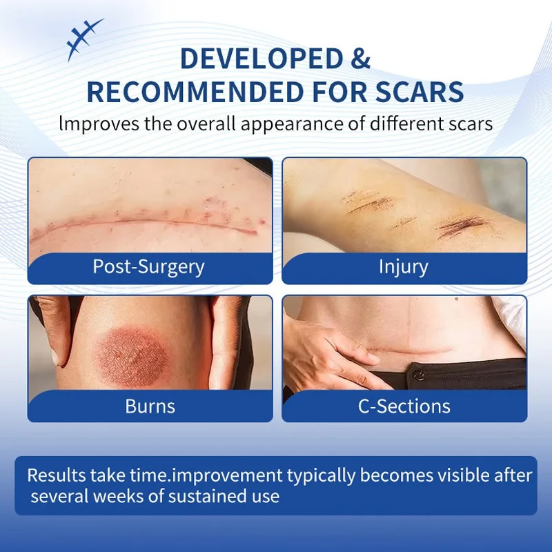 Scar Removal Cream Gel Remove Acne Spots Treatment Stretch Marks Burn Surgical Scar Repair Cream Smoothing Whitening Skin Beauty