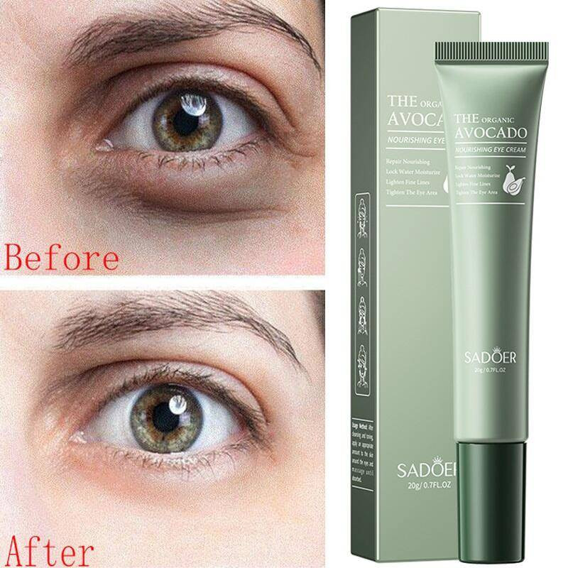 Remove Dark Circles Eye Cream Removal Eye Bags Puffiness Fade Fine Lines Anti-Wrinkle Lifting Firming Moisturizing Eye Care 20g