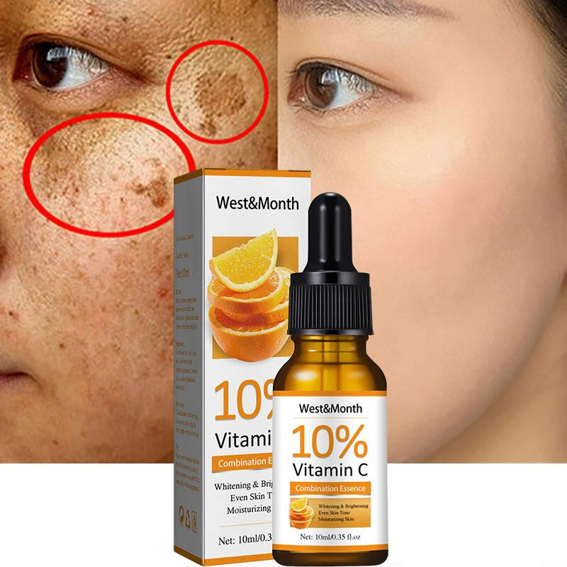 Vitamin C Whitening Freckle Face Serum Removal Melasma Dark Spots Fades Melanin Dull Moisturizing Brightening Nourish Skin Care