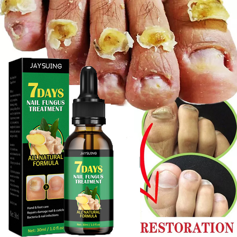 2 Pack Fungal Nail - Maximum Strength Nail Fungus Treatment, Health Care  Solution for Finger & Toenail Fungus, Athlete's Foot - Walmart.com