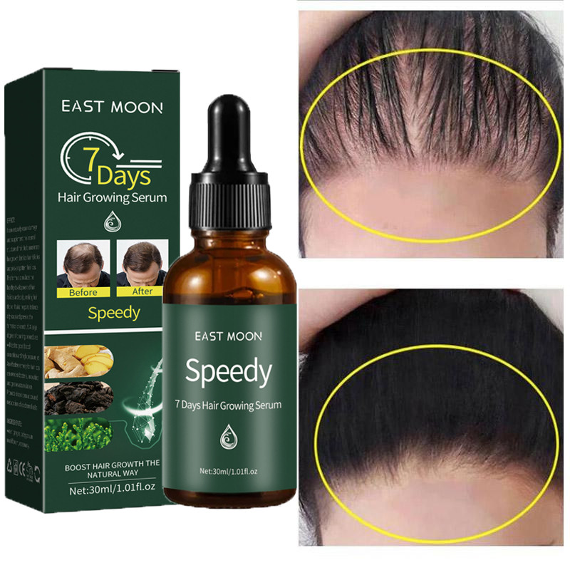 7 Days Ginger Hair Growth Serum Products Anti Hair Loss Treatment Fast Growing Repair Damaged Nourish Hair Beauty for Men Women
