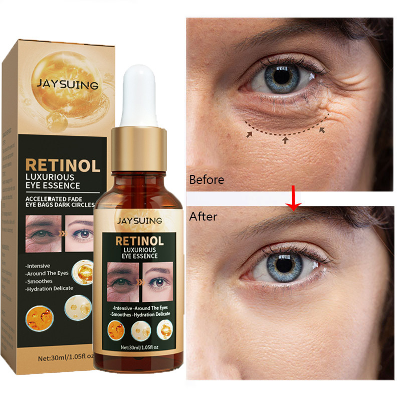 Retinol Wrinkle Removal Eye Serum Anti Dark Circles Fade Fine Lines Remove Eye Bags Puffiness Moisturizing Beauty Skin Care 30ml