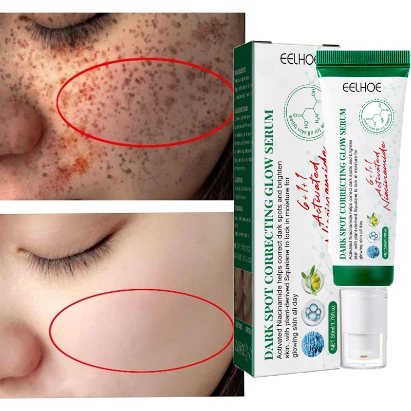 Whitening Freckle Removal Face Cream Remove Melasma Dark Spots Lighten Melanin Brighten Anti-Aging Moisturizing Korean Skin Care