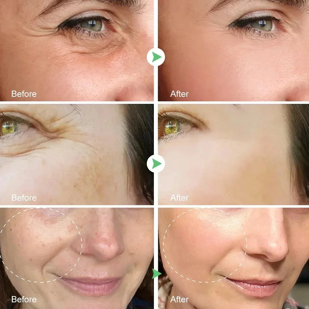 Bee Anti-Wrinkle Lift Face Cream Anti Aging Firming Effect Wrinkle Removal Skin Care Cream Nourish Moisturizing Beauty Products