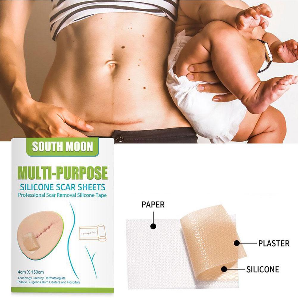 1/3/5/10 Roll Silicone Scar Sheet Painless Scar Repair Tape Roll Effective Scar Waterproof Breathable Ear Beauty Sticker