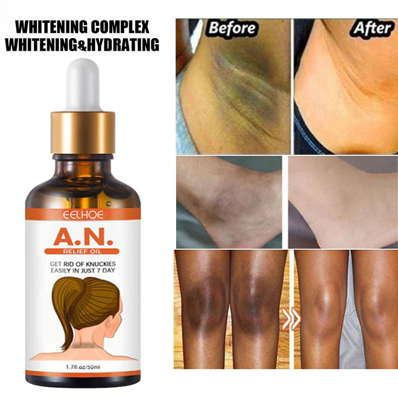 Body Whitening Serum Oil Underarm Knee Buttock Dark Skin Bleach Lighten Melanin Moisturizing Brighten Corrector Beauty Skin Care