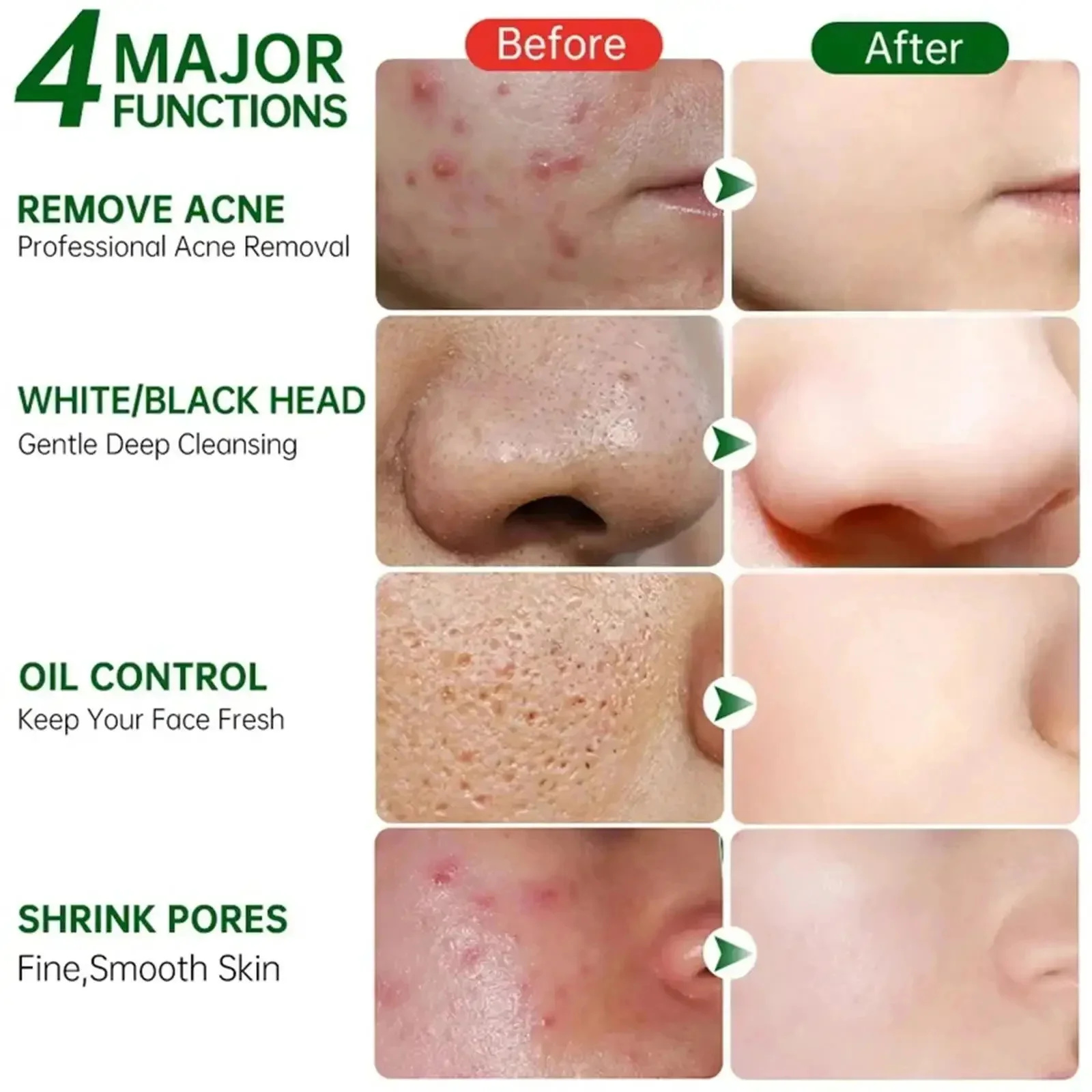 Pore Shrinking Cream Elimination Large Pores Blackehead Remove Acne Pit Repair Gel Tighten Face Smooth Skin Korean Care Products