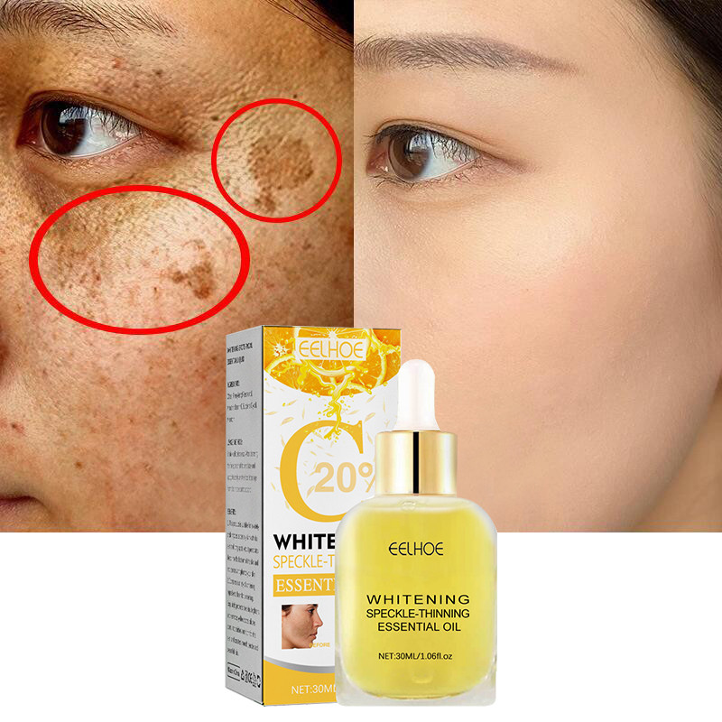 Vitamin C Freckle Whitening Face Serum Remove Dark Spot Melasma Pigment Fade Melanin Brighten Moisturizing Beauty Care Products