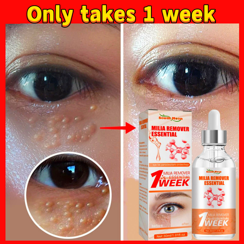 Fat Granules Removal Eye Serum Fade Fine Lines Eye Bags Firming Remove Dark Circles Anti-Puffiness Essence Brighten Beauty Care