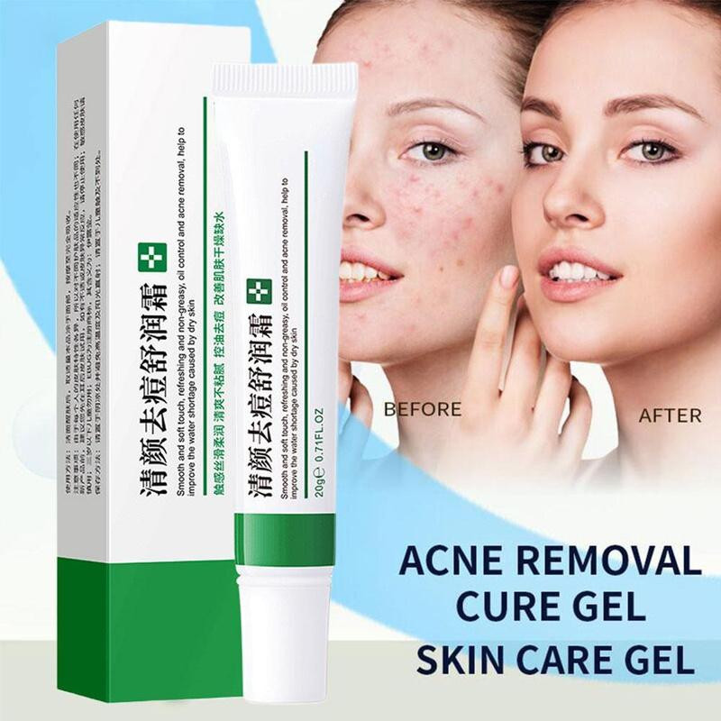 Acne Removal Cream Freckle Cream Shrink Pores Whitening Moisturizing Oil Control Acne Cream Skin Care Acne Treatment Face Cream