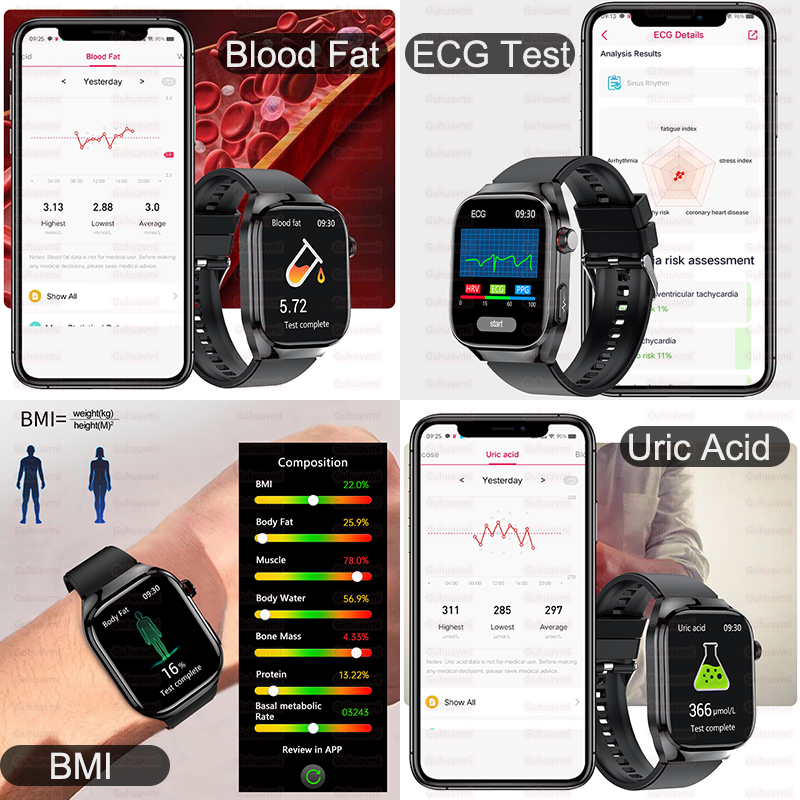 2025 New For XIAOMI Uric acid Blood lipids Smart Watch Men ECG+PPG Blood pressure Blood oxygen Bluetooth Call Health Smartwatchs
