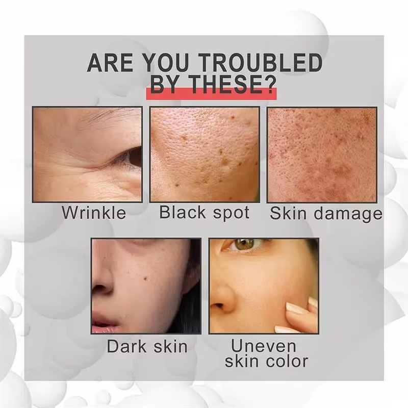 Powerful Dark Spots Remover Whitening Serum Face Freckle Melanin Correcting Anti Pigmentation Brighten Skin Beauty Care Products