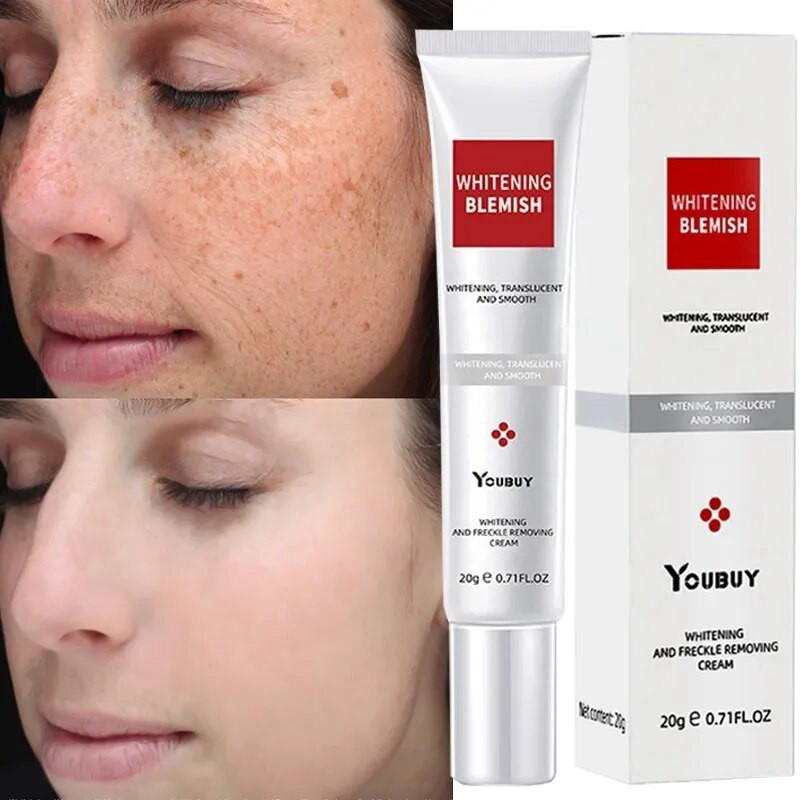 Whitening Freckle Face Cream Remove Melasma Dark Spots Fade Melanin Correcting Brighten Moisturizing Beauty Skin Care Cosmetics