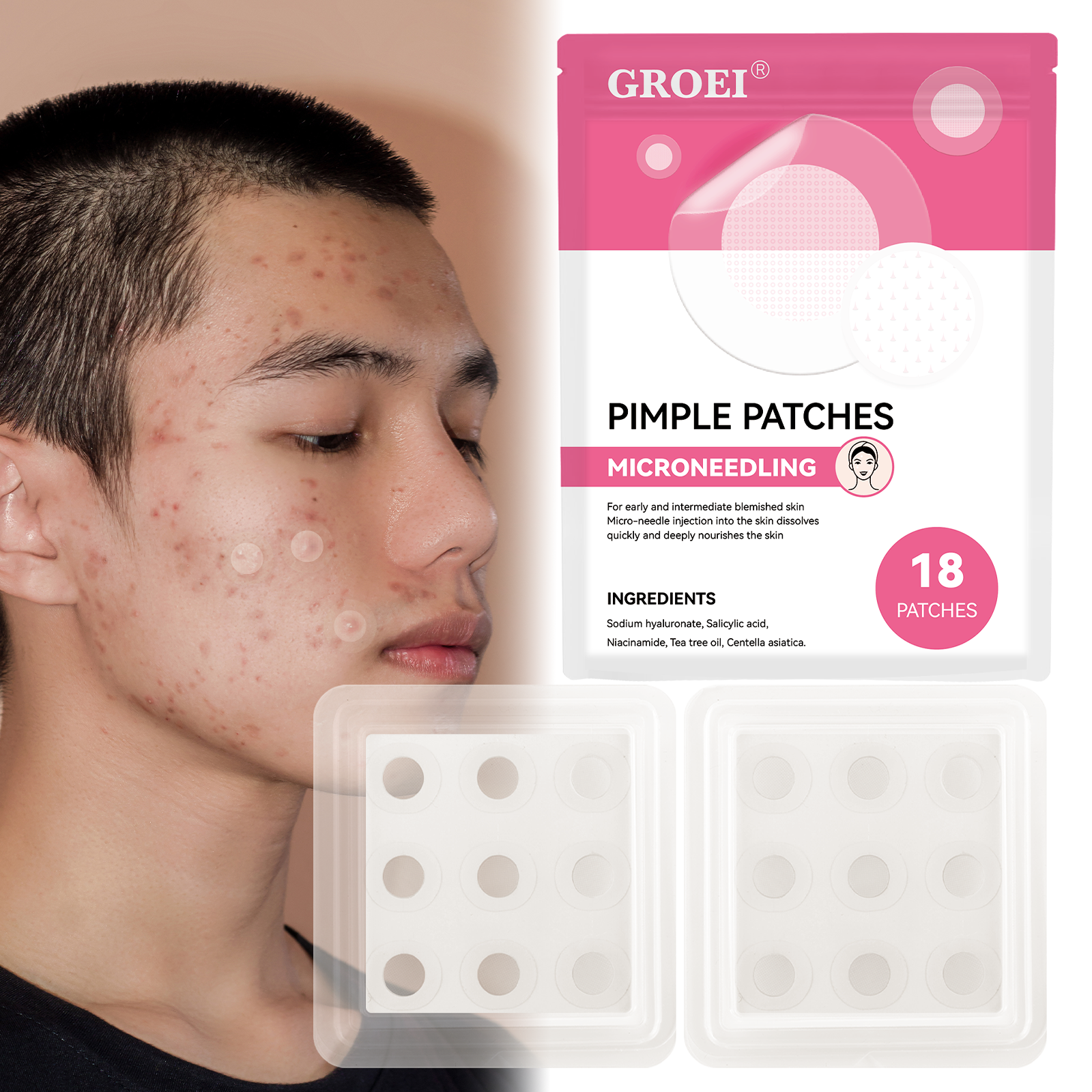 GROEI 18Pcs Microneedle Acne Patches Pimple Invisible Beauty Concealer Blemish Treatment Deep Clean Pores Overnight Recovery