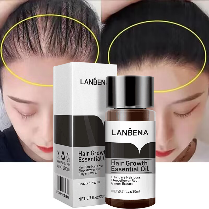 Ginger Hair Growth Essential Oil Products Anti Hair Loss Fast Regrowth Treatment Dense Prevent Baldness Nourish Scalp Hair Care