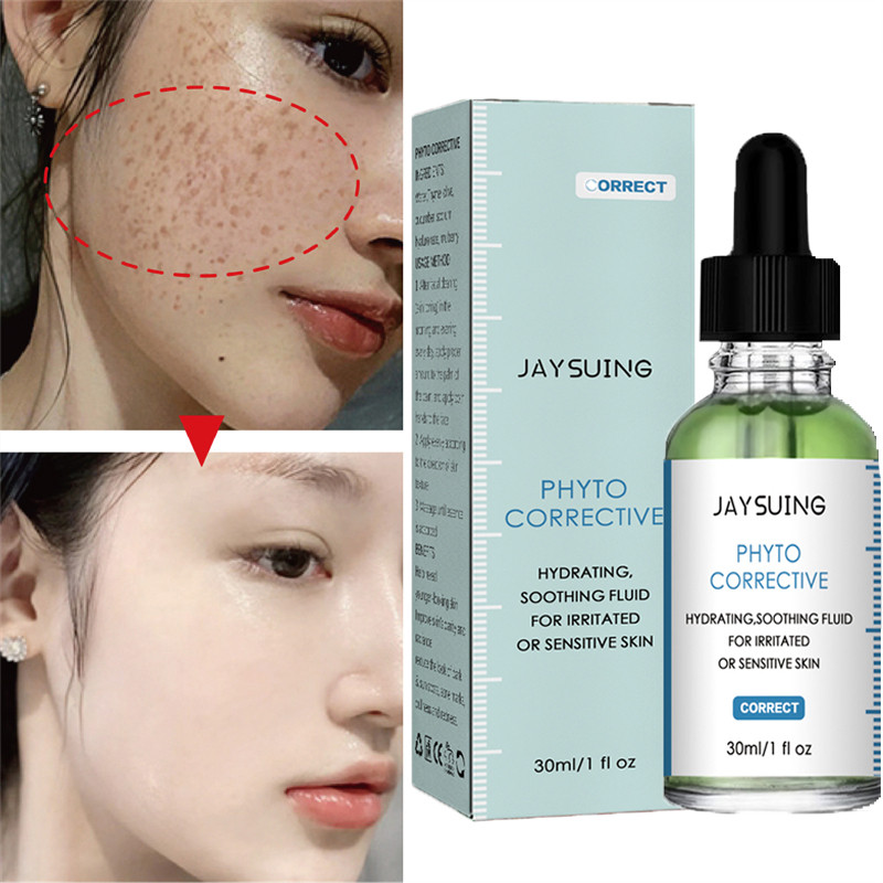 Effective Whitening Freckle Removal Face Serum Fade Dark Spots Acne Marks Pigmentation Melasma Brighten Smooth Beauty Skin Care