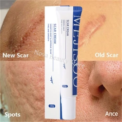 Scar Removal Cream Gel Remove Acne Spots Treatment Stretch Marks Burn Surgical Scar Repair Cream Smoothing Whitening Skin Beauty