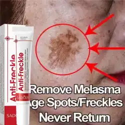 Effective Whitening Freckles Face Cream Dark Spot Corrector Remove Melasma Fade Melanin Pigmentation Brighten Skin Care Products